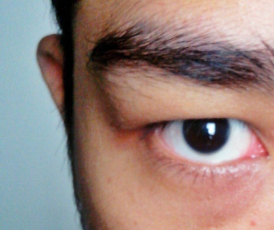 眼 眼