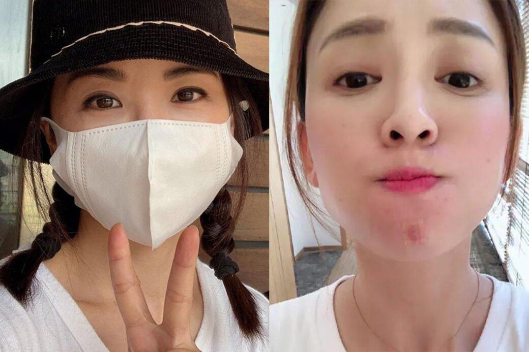 【口罩肌暗瘡】10款iHerbs推薦必買暗瘡護理產品:洗面乳、爽膚水、暗瘡貼消炎去痘痘! 【口罩肌暗瘡】10款iHerbs推薦必買暗瘡護理產品:洗面乳、爽膚水、暗瘡貼消炎去痘痘!