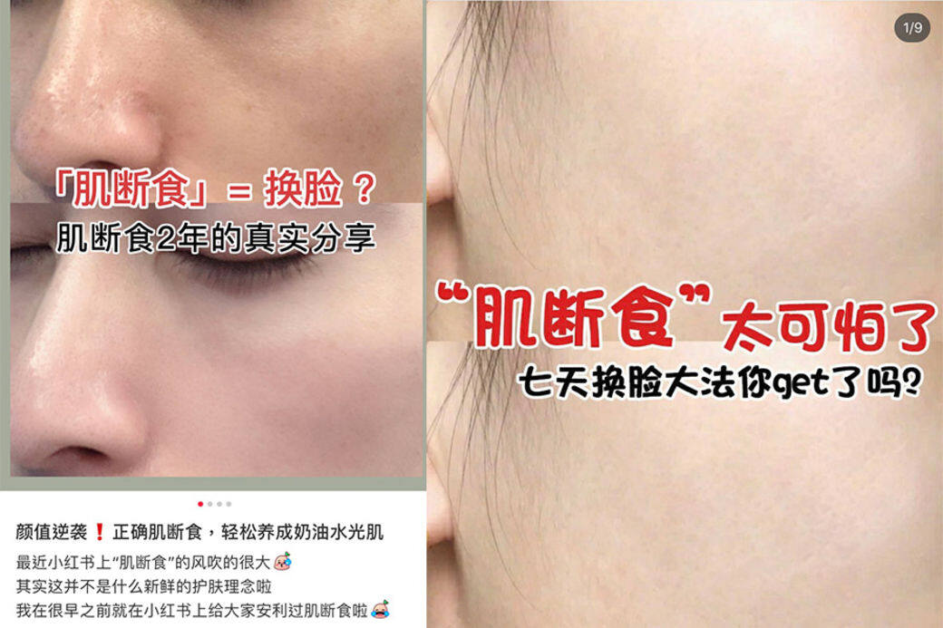 在網上或小紅書上,有不少「美妝達人」分享「肌斷食」護膚法,聲稱適合暗瘡肌 在網上或小紅書上,有不少「美妝達人」分享「肌斷食」護膚法,聲稱適合暗瘡肌