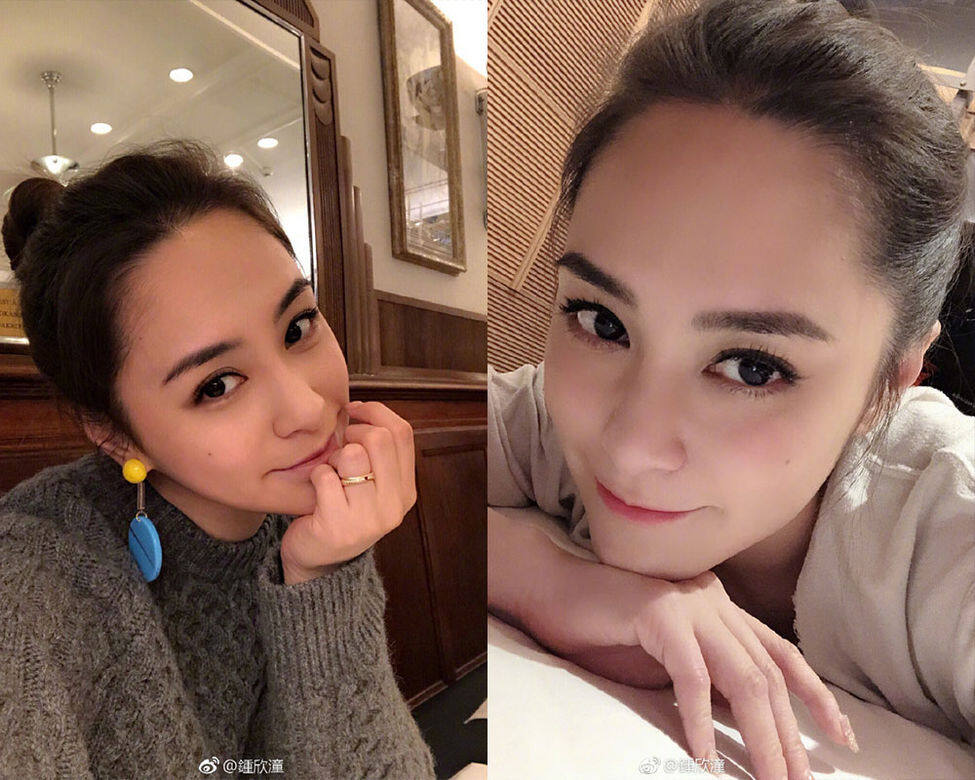 身體腫脹不一定是肥胖 身體腫脹不一定是肥胖