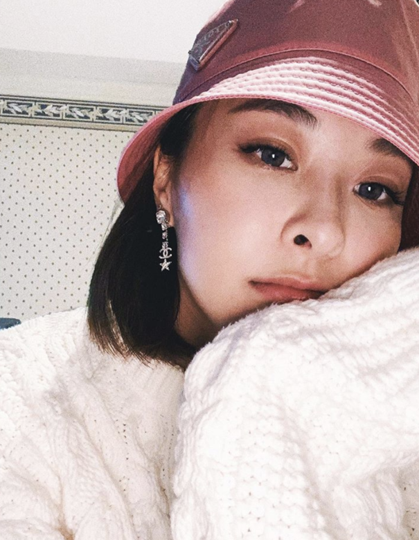 眼部肌膚格外脆弱,皮膚科醫生陳厚毅指出,眼周細紋、眼底幼紋、魚尾紋等 眼部肌膚格外脆弱,皮膚科醫生陳厚毅指出,眼周細紋、眼底幼紋、魚尾紋等