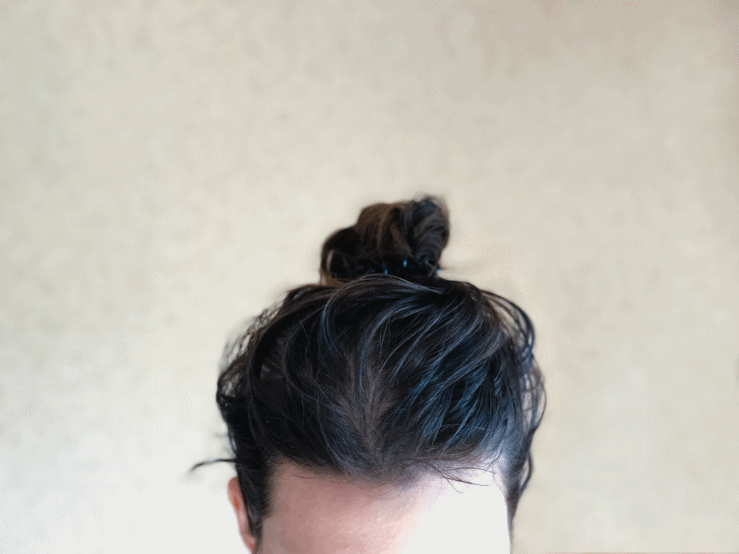 頭髮護理是夏天的惱人問題。頭頂上的油味絕對會成為你的「減分位」。其實一些生活上容易忽略的小細節,足以令你與頭臭扯上關係! 頭髮護理是夏天的惱人問題。頭頂上的油味絕對會成為你的「減分位」。其實一些生活上容易忽略的小細節,足以令你與頭臭扯上關係!