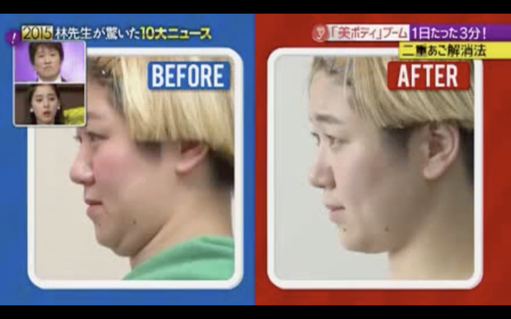 五秒瘦面操的動作很簡單,只要先將雙手屈曲放在頭部後方,慢慢將頭壓 五秒瘦面操的動作很簡單,只要先將雙手屈曲放在頭部後方,慢慢將頭壓