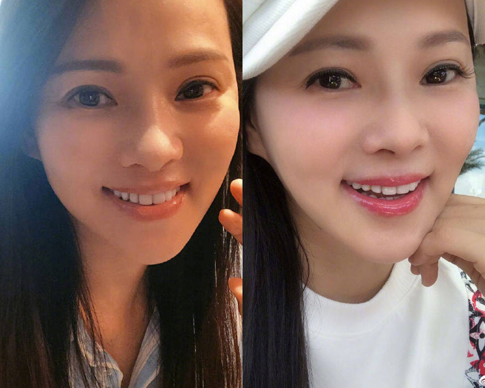 伊能靜美容秘訣 1. 兩年來一直箍牙 伊能靜美容秘訣 1. 兩年來一直箍牙