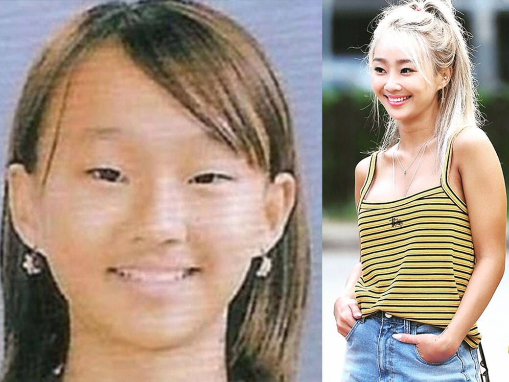 韓國女團 SISTAR 的孝琳大方承認自己曾經整容 韓國女團 SISTAR 的孝琳大方承認自己曾經整容
