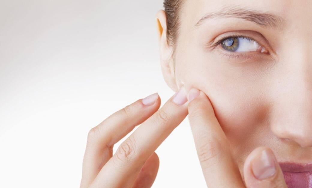 暗瘡, 護膚, 涌潔, skincare 暗瘡, 護膚, 涌潔, skincare