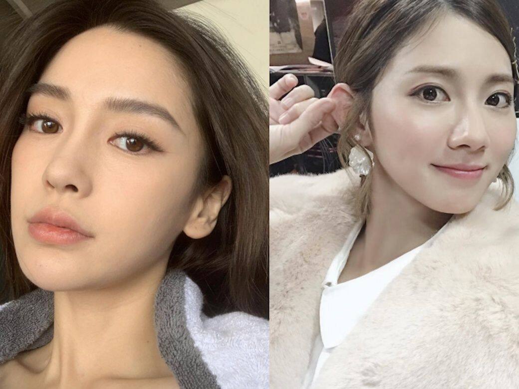 長針眼熱敷或冰敷?Angelababy「豆花妹」也曾受眼挑針困擾!7招速效舒緩眼挑針 長針眼熱敷或冰敷?Angelababy「豆花妹」也曾受眼挑針困擾!7招速效舒緩眼挑針