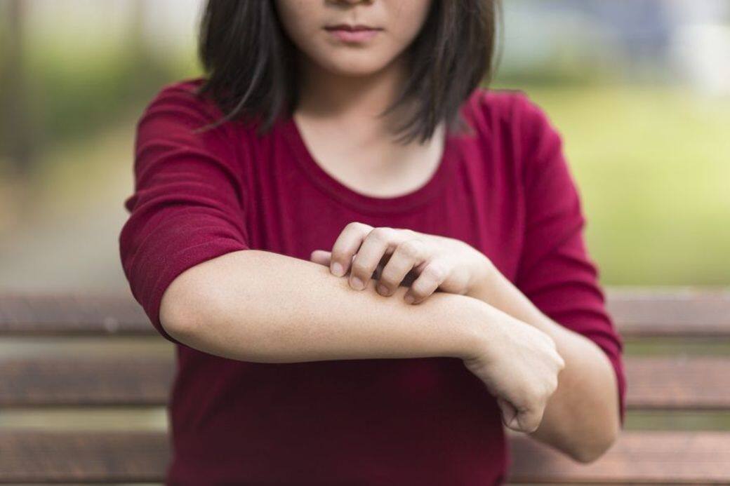 另外亦有人對羊毛敏感,因為羊毛容易「拮到皮膚」,肌膚容易敏感的話,便會 另外亦有人對羊毛敏感,因為羊毛容易「拮到皮膚」,肌膚容易敏感的話,便會