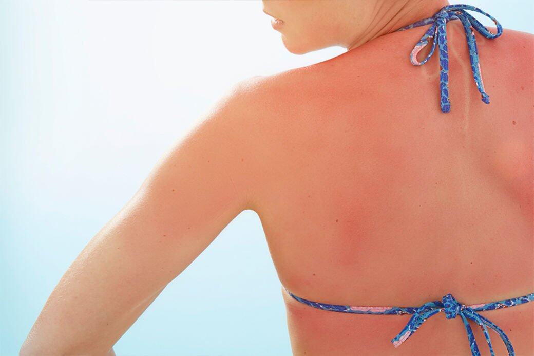 SPF(Sun Protection Factor)是全球公認對紫外線UVB的防護標準, 亦是大眾所認知的「防曬系 SPF(Sun Protection Factor)是全球公認對紫外線UVB的防護標準, 亦是大眾所認知的「防曬系