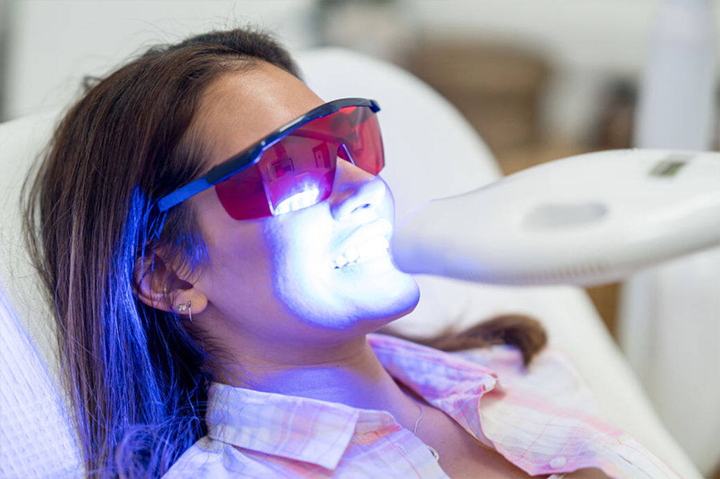 這次找來WhiteLabshk teeth whitening centre來一個美白牙齒Q&A,一次過解答大家對美白牙齒的 這次找來WhiteLabshk teeth whitening centre來一個美白牙齒Q&A,一次過解答大家對美白牙齒的