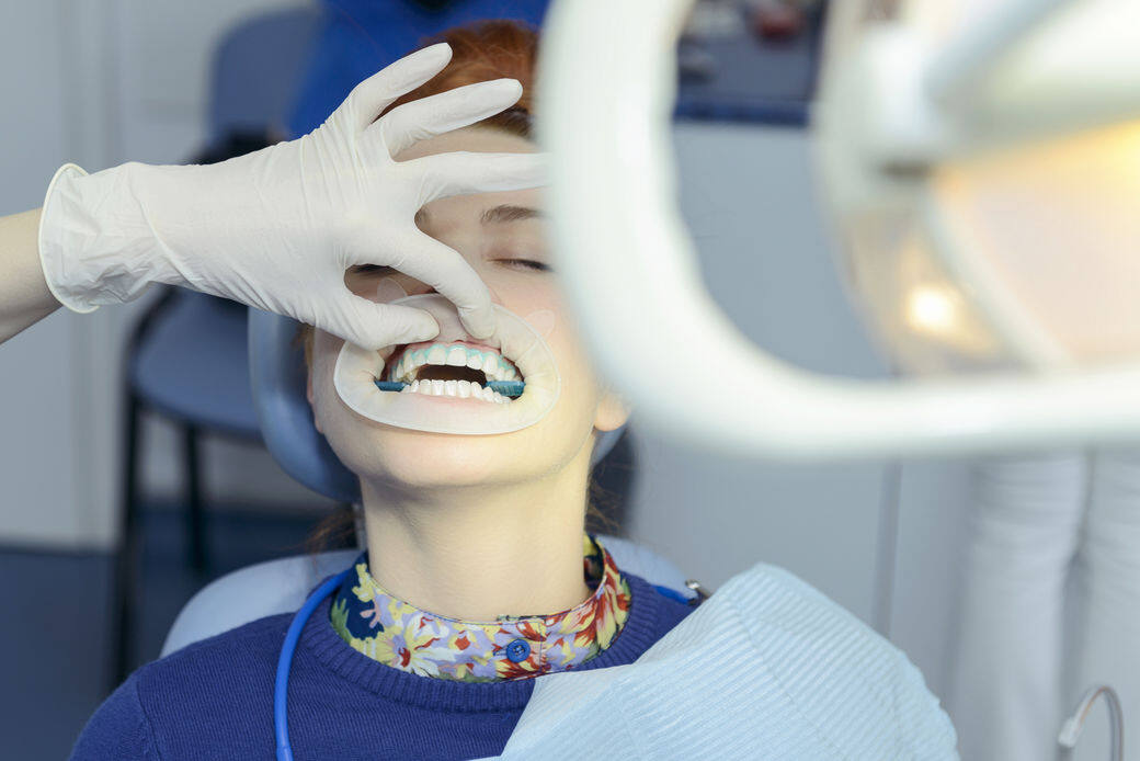 患有蛀牙、牙周病或牙齒敏感者應該在使用美白牙貼前先諮詢醫生意見