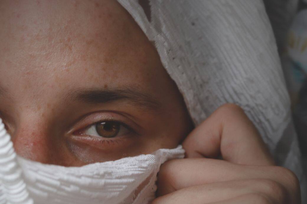 較早期的眼瘡眼挑針，可試用毛巾熱敷自行治理，方法簡單。先預備清潔的