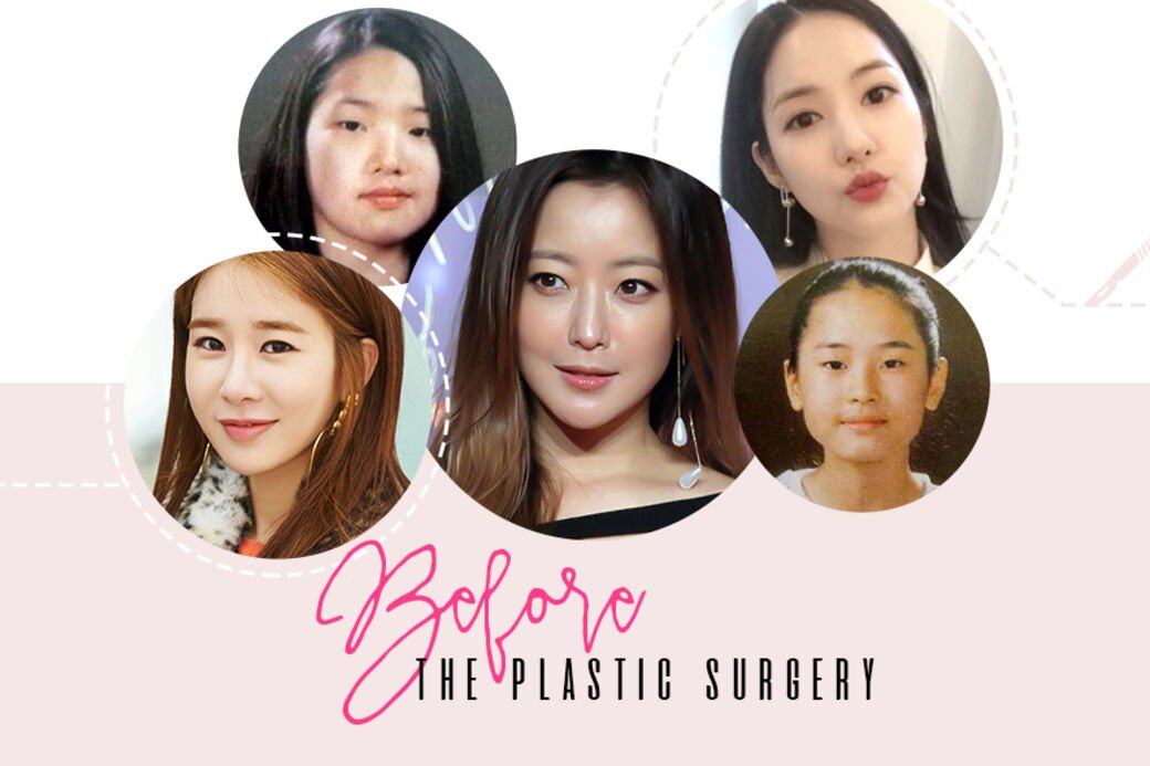 看韓國女星整容前的樣子 你絕不可能辨認到她們是誰 Elle Hk 看韓國女星整容前的樣子 你絕不可能辨認到她們是誰 Elle Hk