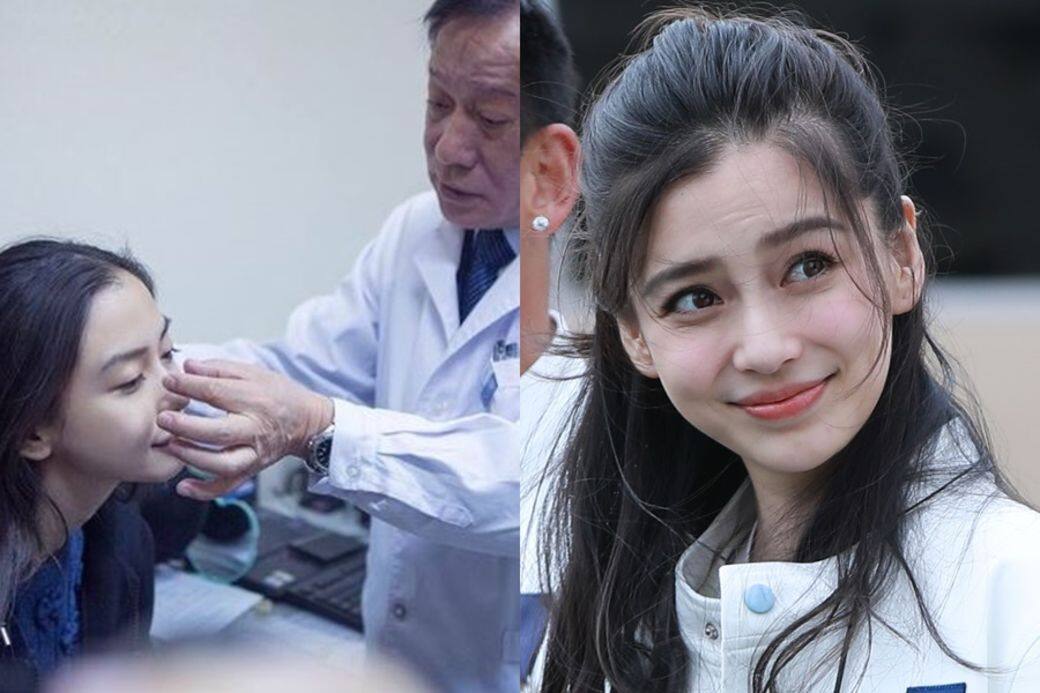 Angelababy, 楊穎, 小海綿, 整容 Angelababy, 楊穎, 小海綿, 整容