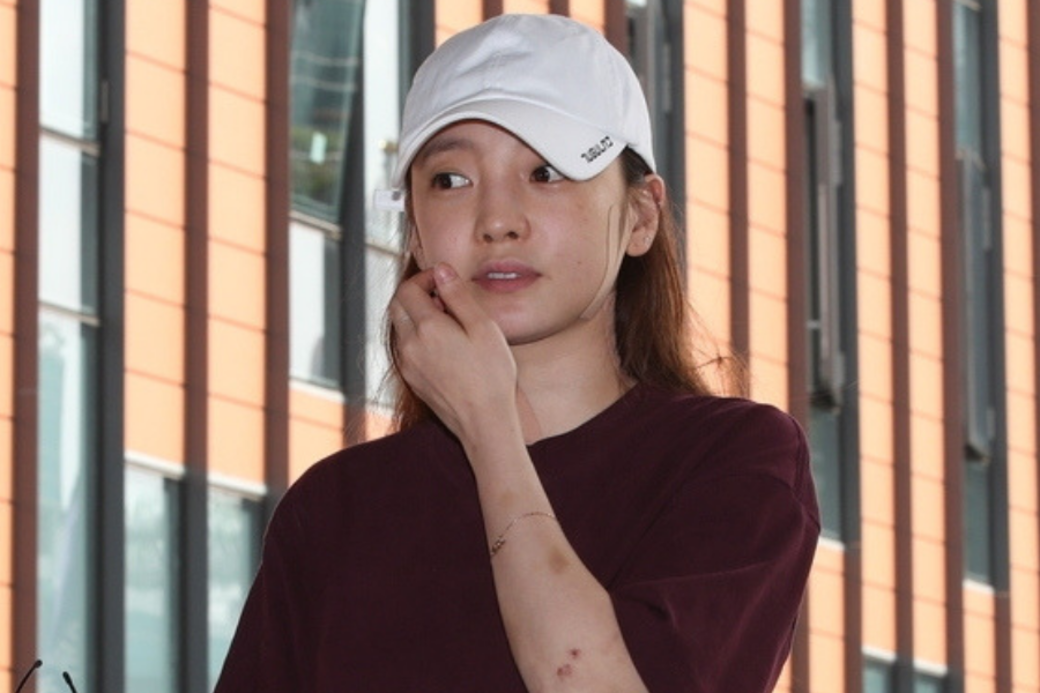 被指對「清潭洞劉亞仁」施暴!具荷拉以全身瘀青的相片反擊 被指對「清潭洞劉亞仁」施暴!具荷拉以全身瘀青的相片反擊