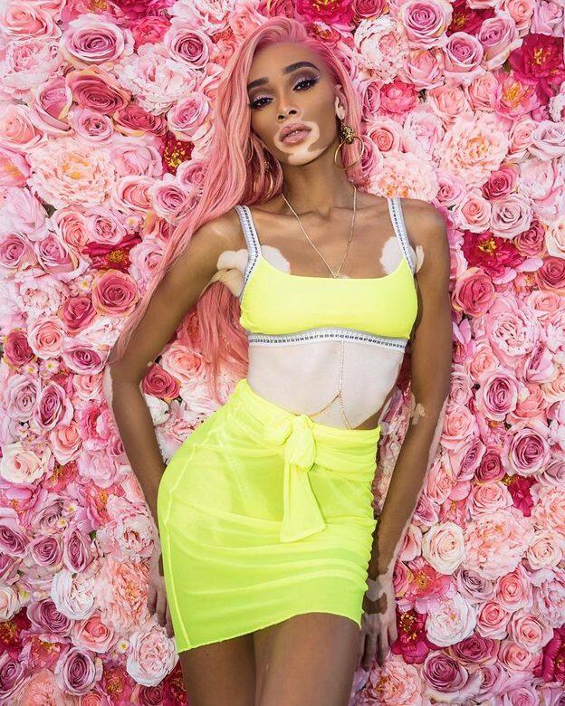 Winnie Harlow Winnie Harlow