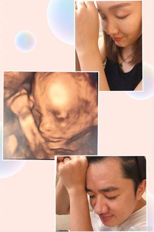 李亞男34歲生日,老公王祖藍也趁機分享女兒的超聲波照片,他更跟李亞 李亞男34歲生日,老公王祖藍也趁機分享女兒的超聲波照片,他更跟李亞