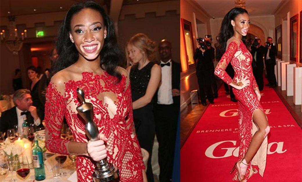 Winnie Harlow, 模特兒, Fashion, 時裝 Winnie Harlow, 模特兒, Fashion, 時裝