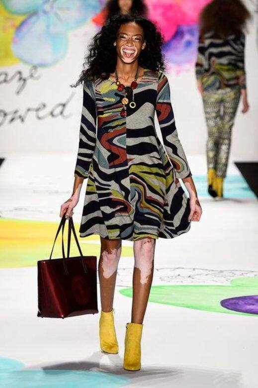Winnie Harlow, 模特兒, Fashion, 時裝 Winnie Harlow, 模特兒, Fashion, 時裝