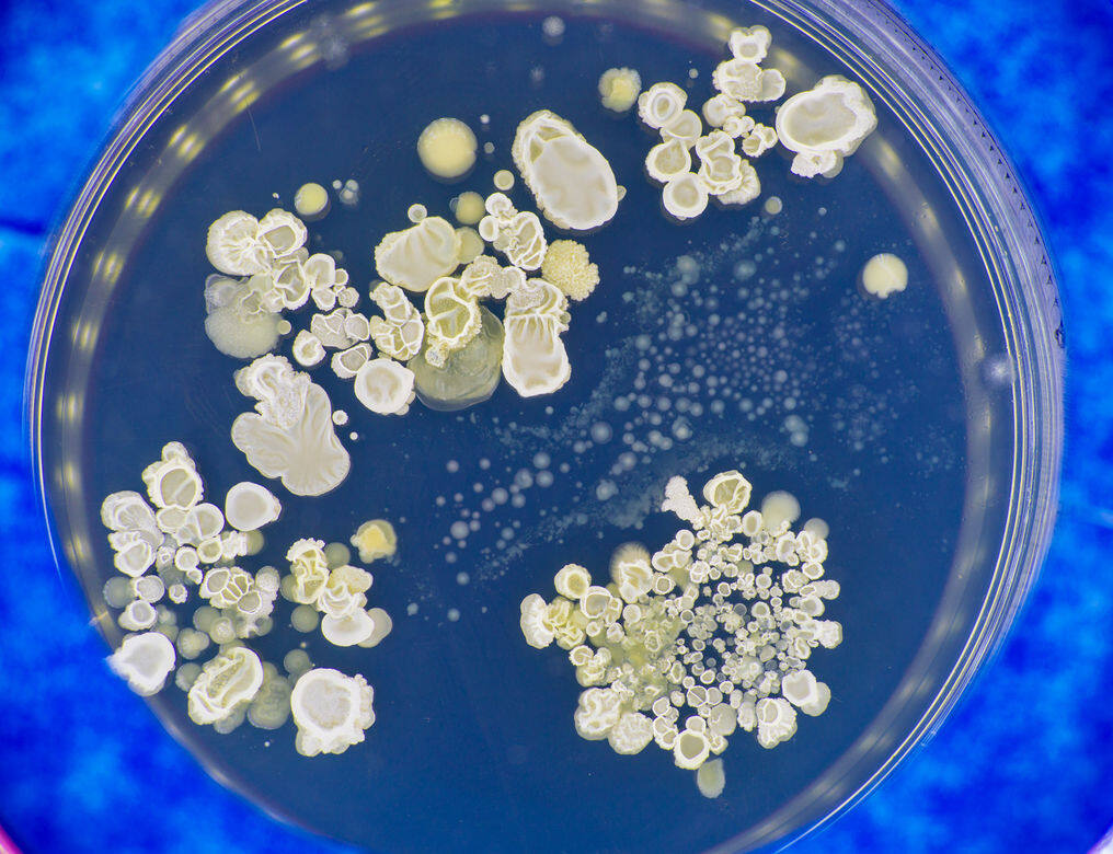 腳部常見的真菌叫白癬菌，也就是俗稱的香港腳菌，這些真菌不只會引起