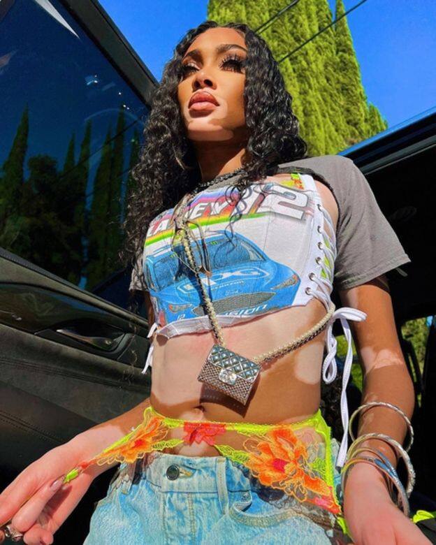 Winnie Harlow IG@winnieharlow1994年出生的Winnie Harlow本名Chantelle Whitney Brown-Young,在年僅4歲時得到罕見疾病「白 Winnie Harlow IG@winnieharlow1994年出生的Winnie Harlow本名Chantelle Whitney Brown-Young,在年僅4歲時得到罕見疾病「白