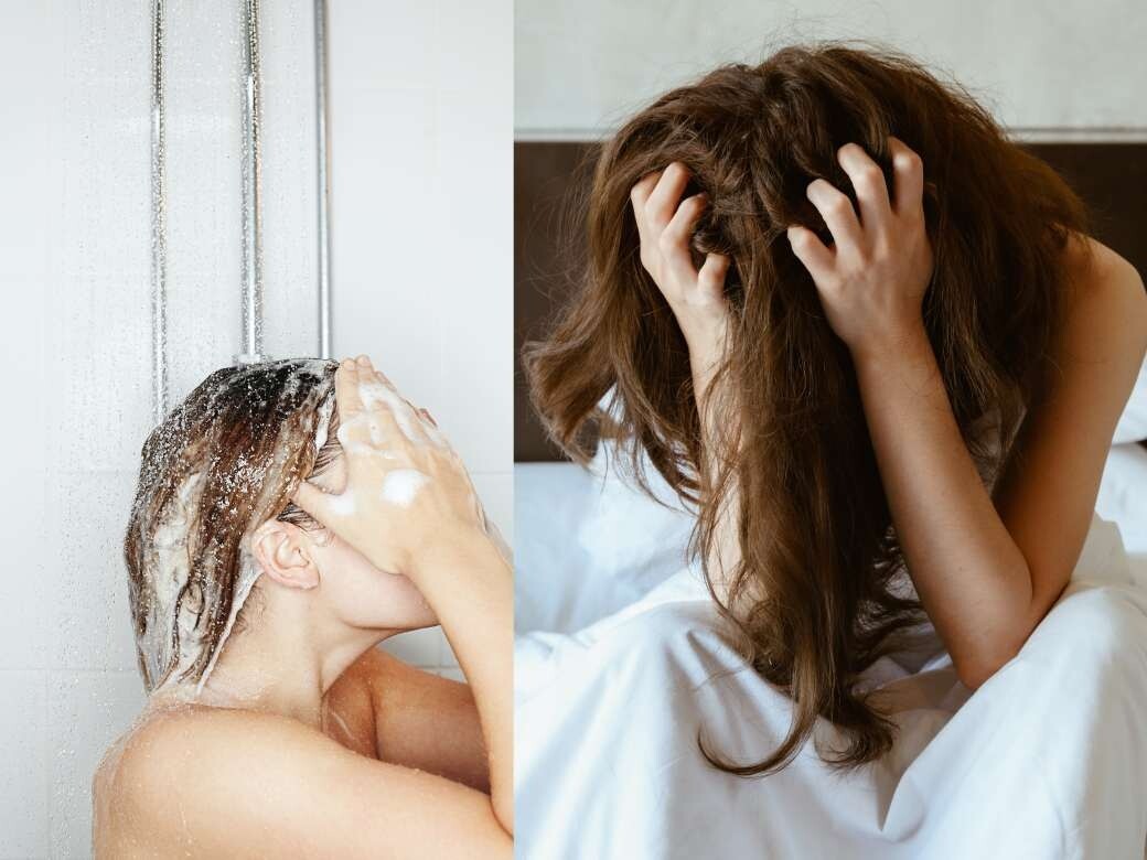 頭瘡洗頭水推薦｜解決頭瘡、頭油頭皮護理變洗頭習慣防脫髮
