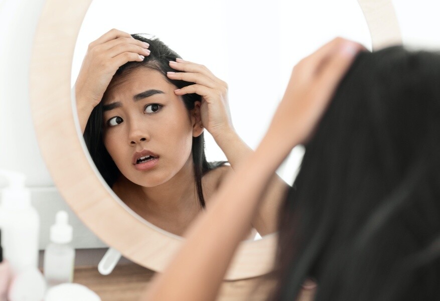 甩頭髮原因？10個脫髮成因令女性甩頭髮頭頂稀疏！脫髮改善必吃6大食物推薦