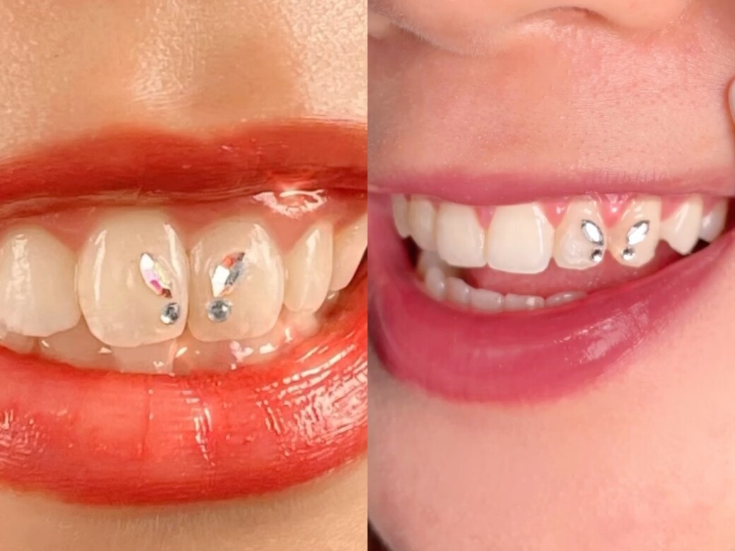 Lisa、XG成員都有貼的牙鑽，你跟上潮流了嗎？分享5種牙鑽款式。