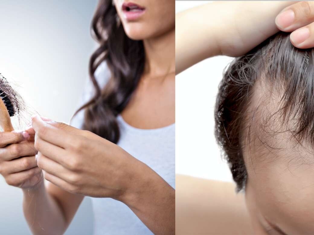 頭髮急急長效果原理｜8個加速頭髮生長髮量方法及好用防脫髮洗頭水推介