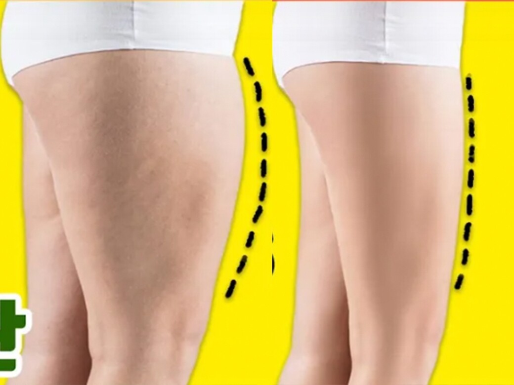 拉筋瘦腿改善大腿前側凸出你有大腿前側突出問題嗎？