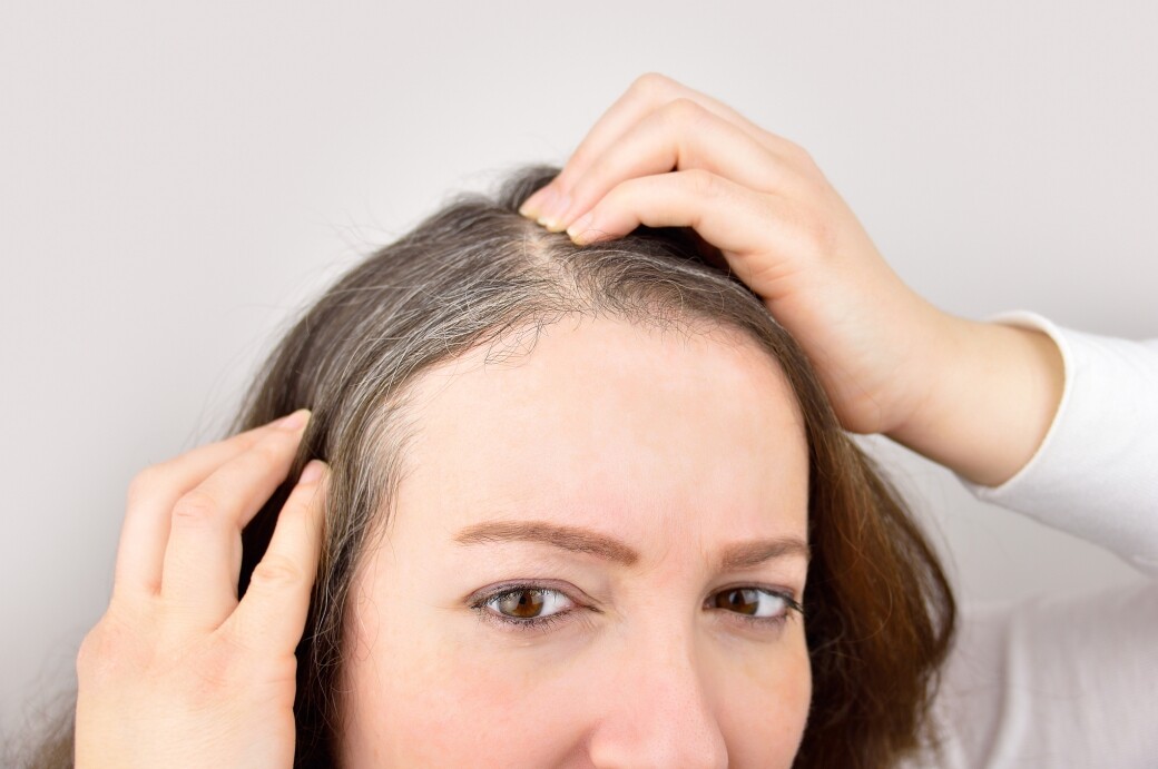營養師指黑芝麻含有促進血液循環和新陳代謝的鐵質，以及減少頭髮細