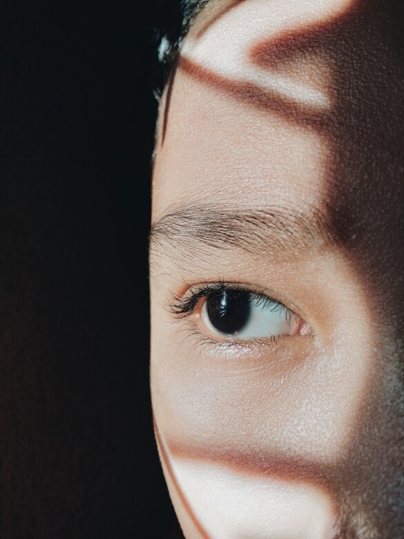 黑眼圈的出現，最令人煩惱的是四周膚色同時會變得暗沉、眼下皮膚浮腫