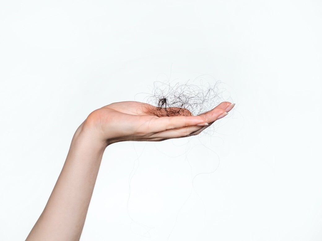 Hair Loss Treatments for Women關於女性脫髮