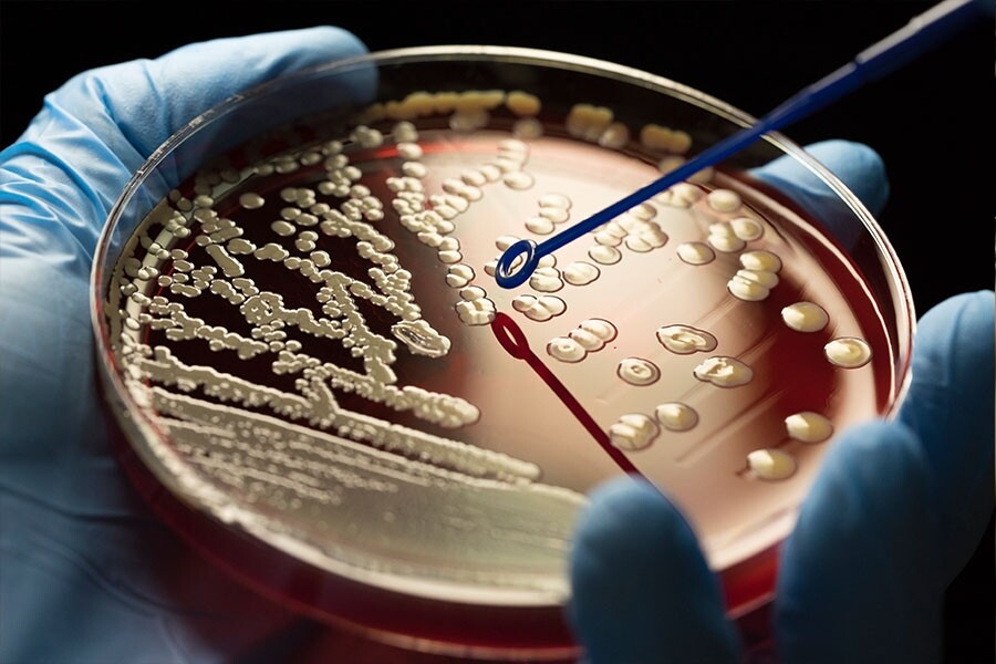 粉撲掃具上的細菌其實源自我們自己。原來，人的皮膚表面有超過2,000種