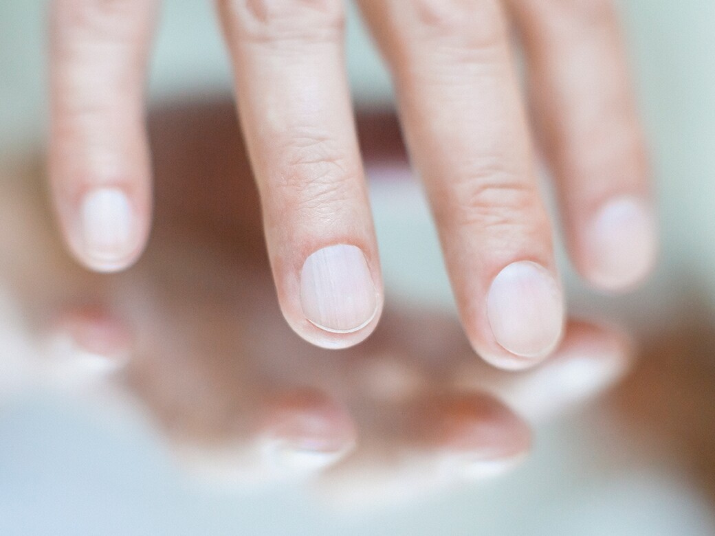 而不少人的指甲上都可能出現凹凹凸凸的直紋，但其實每個人隨年齡增