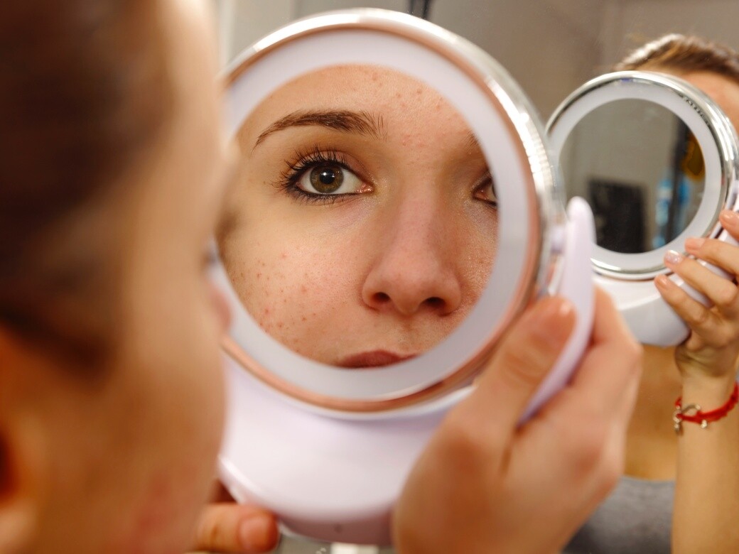 如何處理戴口罩後失控的皮膚敏感暗瘡？你需要試Probiotics 益生菌保養