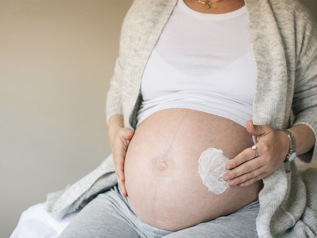 妊娠紋甚麼時候出現？婦產科醫生講解4個懷孕妊娠紋原因及預防方法！
