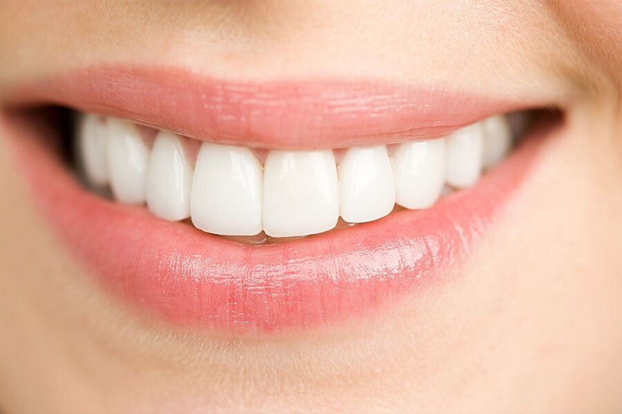 若有用美白牙貼的習慣的話，建議做美白牙齒療程之前先停用牙貼，始終