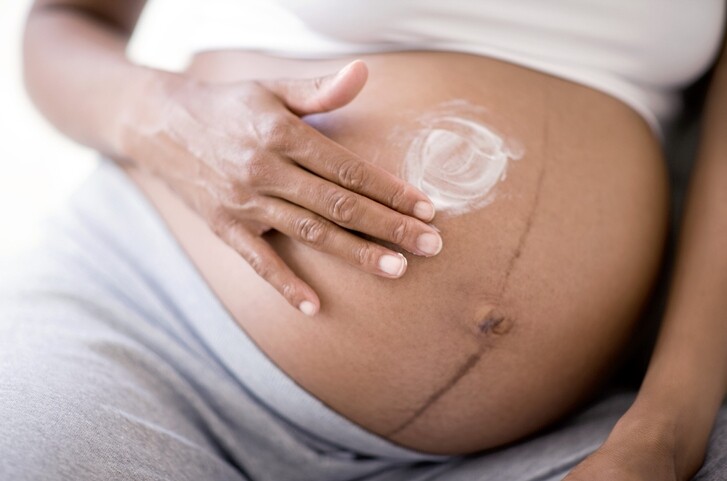 懷孕6個月之後會發覺肚子上開始出現妊娠紋，把維他命E塗在肚皮上