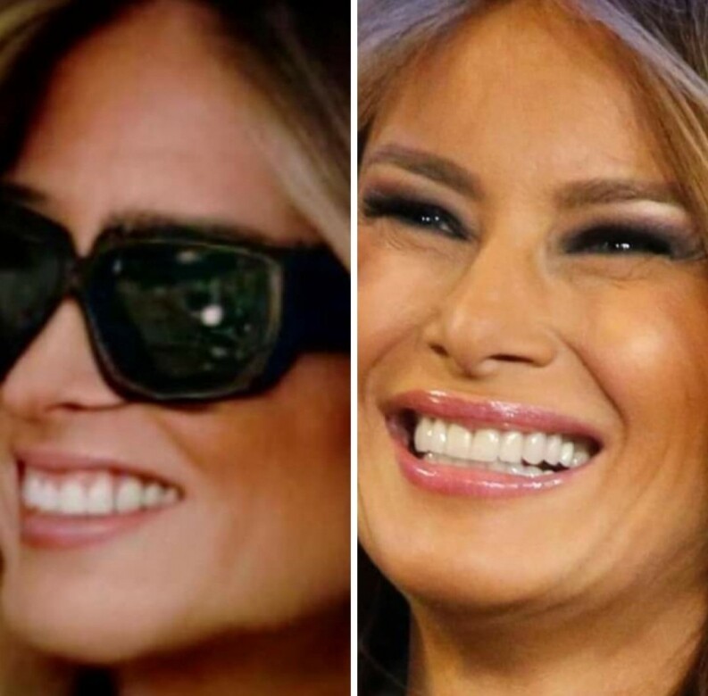 有網友製作出她與之前照片的對比圖，指兩人的牙齒形狀完全不同，最新