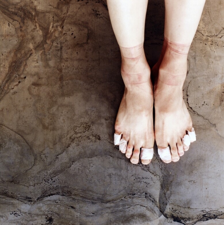 要預防，首先要知道水泡的形成原因：腳起水泡的原因，是因為當皮膚受長