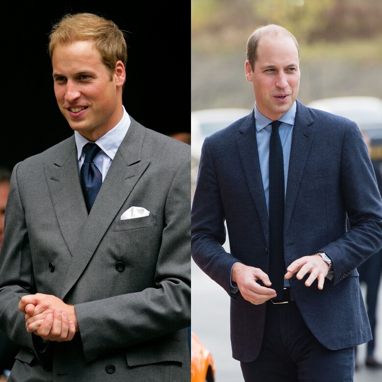 Prince William很遺憾地時間並沒有為威廉王子的頭髮帶來生機。在2009年開始，他便