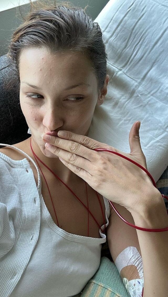 Bella Hadid 發生了甚麼事，因萊姆病而消失，這個症有多可怕？