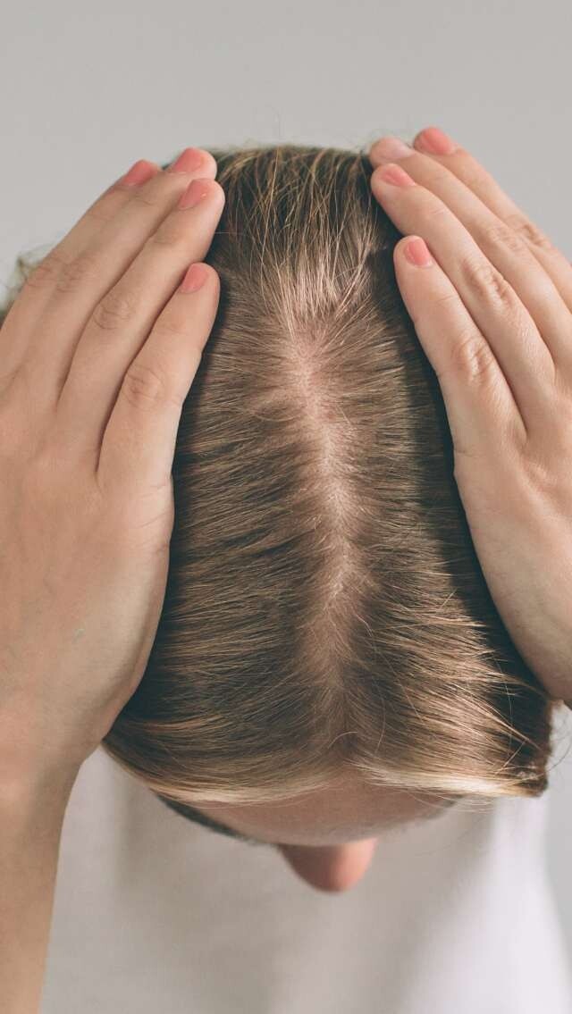 頭皮痕癢怎麼辦？頭皮止癢方法