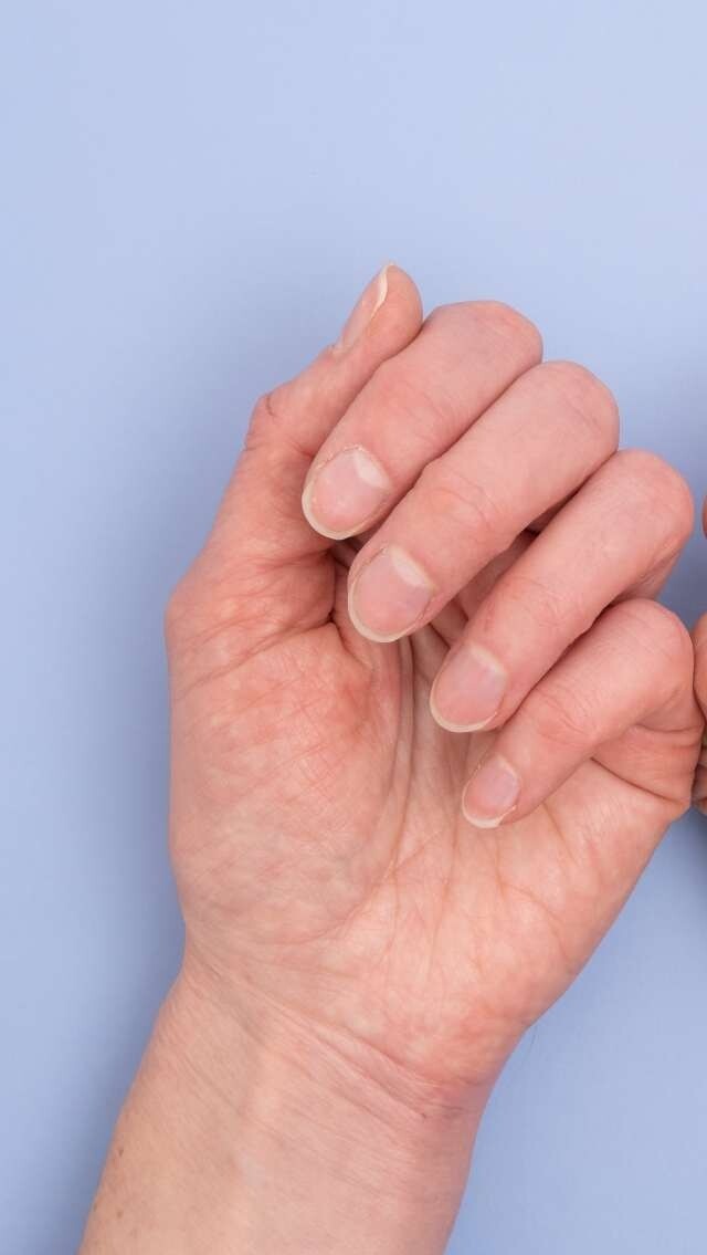 指甲顏色外觀怎樣才算健康？ 指甲也能揭示身體毛病