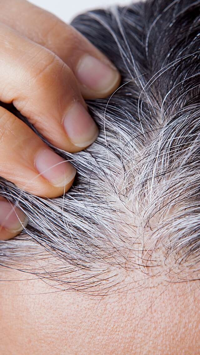 白頭髮成因是什麼！長白頭髮位置反映健康？