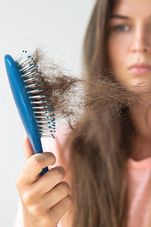 解決脫髮問題！認清5大頭髮稀疏原因，好用頭皮護理產品推介