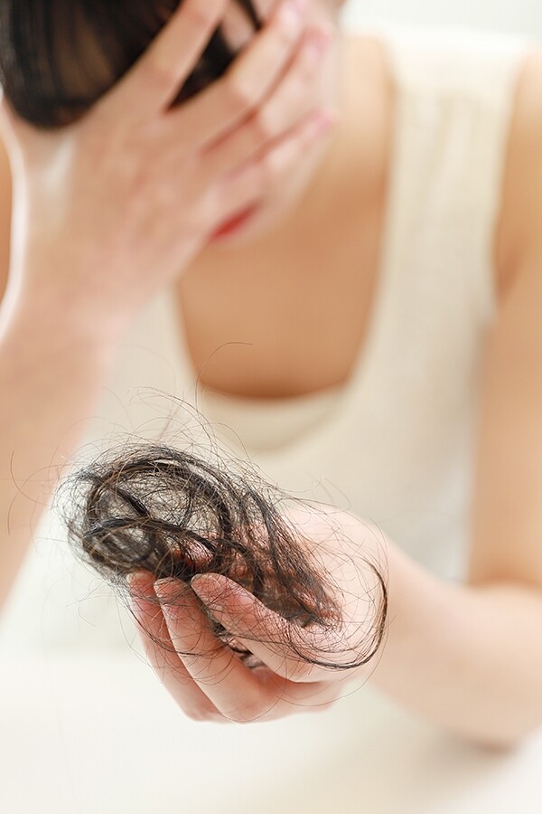 20至30歲都開始脫髮！專家解答8個女士脫髮問題及生髮方法