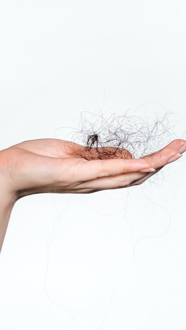 Hair Loss Treatments for Women關於女性脫髮