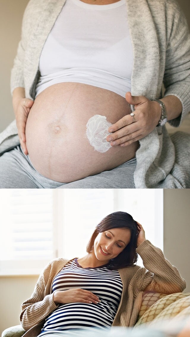 妊娠紋消除方法是甚麼？妊娠紋什麼時候出現？醫生分析原因及編輯整合妊娠紋霜